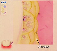 バイオフィルム3