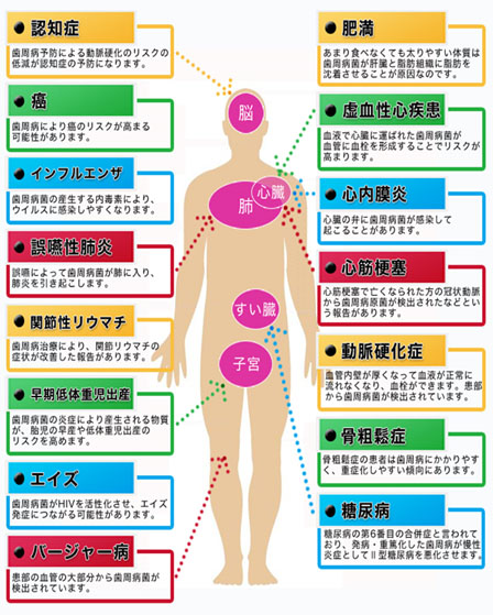 歯周病菌が影響する慢性疾患