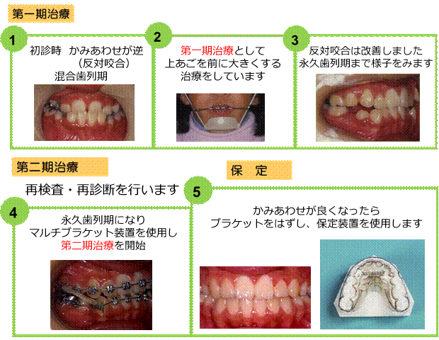 治療の流れの例