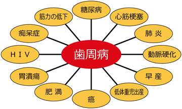 歯周病と関連がある全身の病気